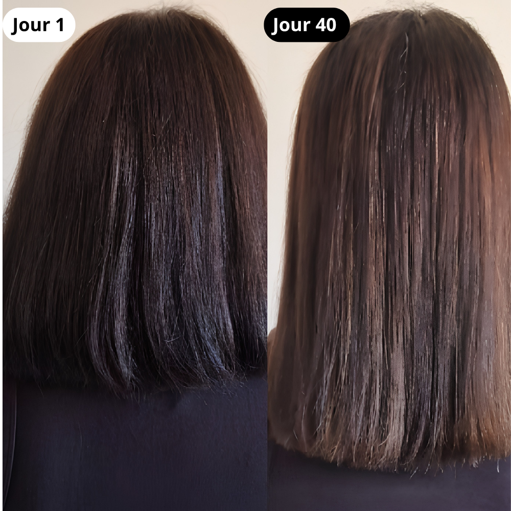 Brosse Stimulante Cuir Chevelu LED & Sérum